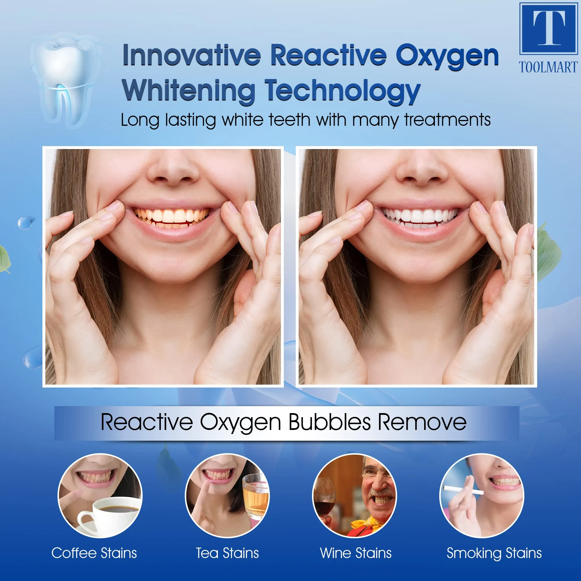 3D Teeth Whitening Strips 28 Pcs -Non Sensitive- Mint Flavor-Teeth Whitening Kit Advanced Teeth Whitener Strips Whitening Teeth Tooth Whitening Strips for White Teeth